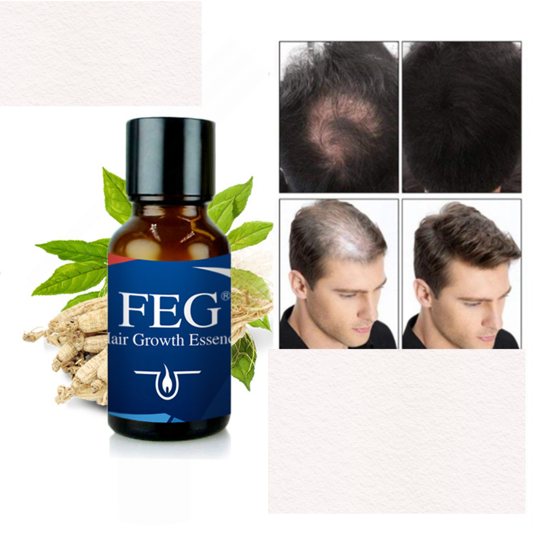 COMBO FEG - TARTA LA CAÍDA DEL CABELLO DE FORMA EFECTIVA