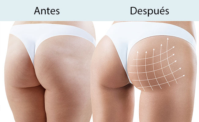 ACEITE REAFIRMANTE DE GLUTEOS
